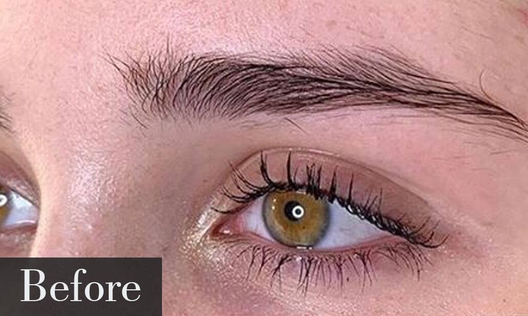 Before Lamination Brow