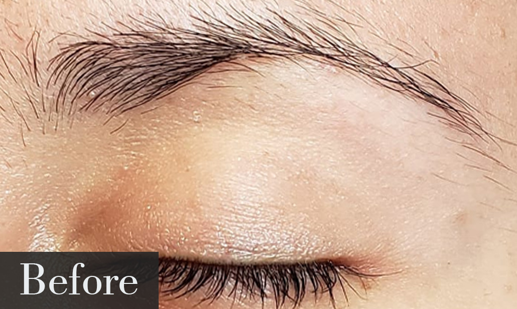 Before Microblading