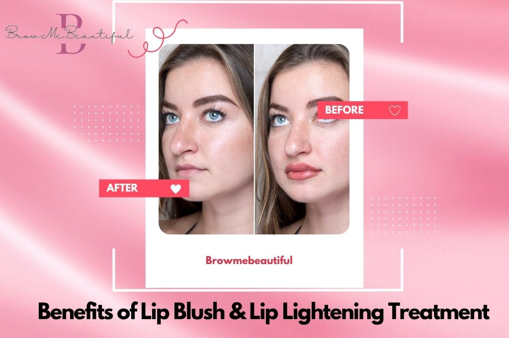 Lip Lightening 